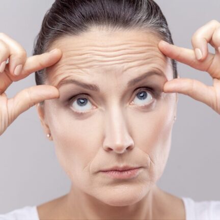 Lifting de Supercílios