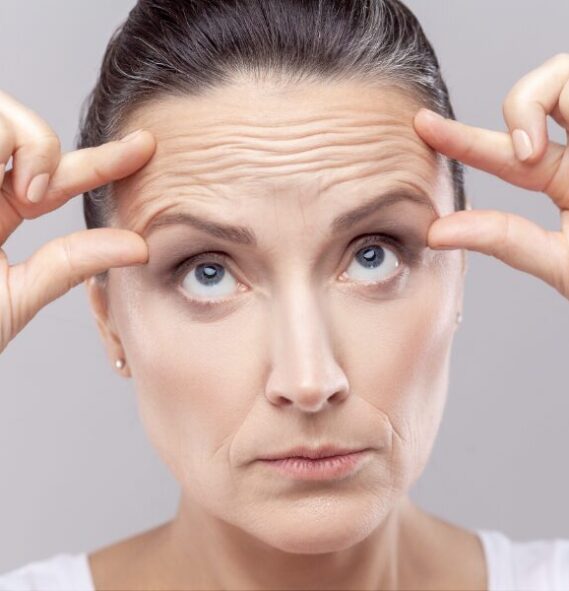 Lifting de Supercílios