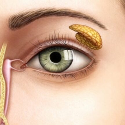 Obstrução das Vias Lacrimais